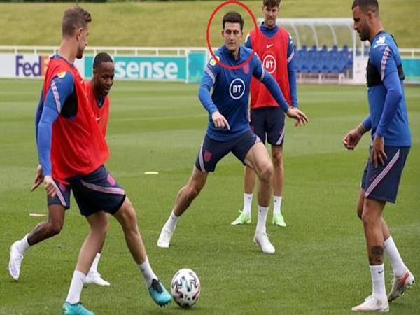 Bóng đá QT sáng 17/6: Maguire có thể thi đấu trận gặp Scotland Bóng đá QT sáng 17/6: Maguire có thể thi đấu trận gặp Scotland